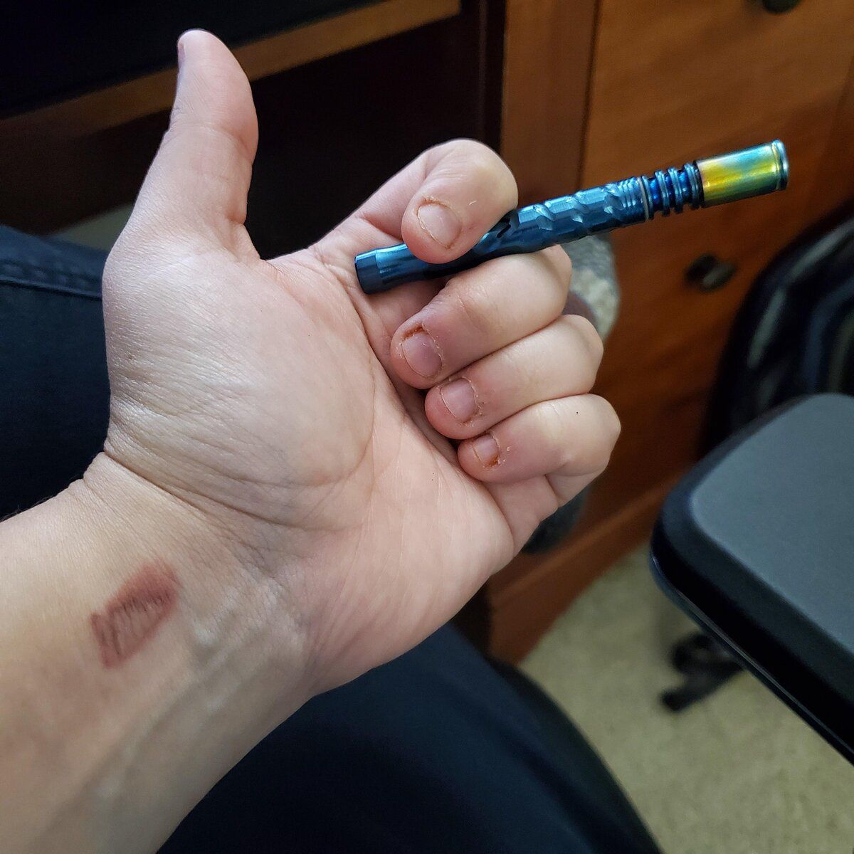 khov93-Instinctually_tried_to_catch_my_dynavap_when_I_fell._Got_branded._Welcome_to_the_dynave...jpg