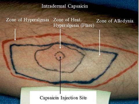 capsaicin-test-skin.jpg